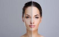 美白的七大誤區你能認清嗎 能夠美白肌膚的食物