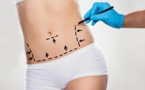 花生醬熱量高為什么還減肥