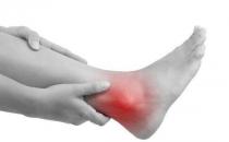 推薦治療關(guān)節(jié)炎的12個偏方 治療關(guān)節(jié)炎有效果